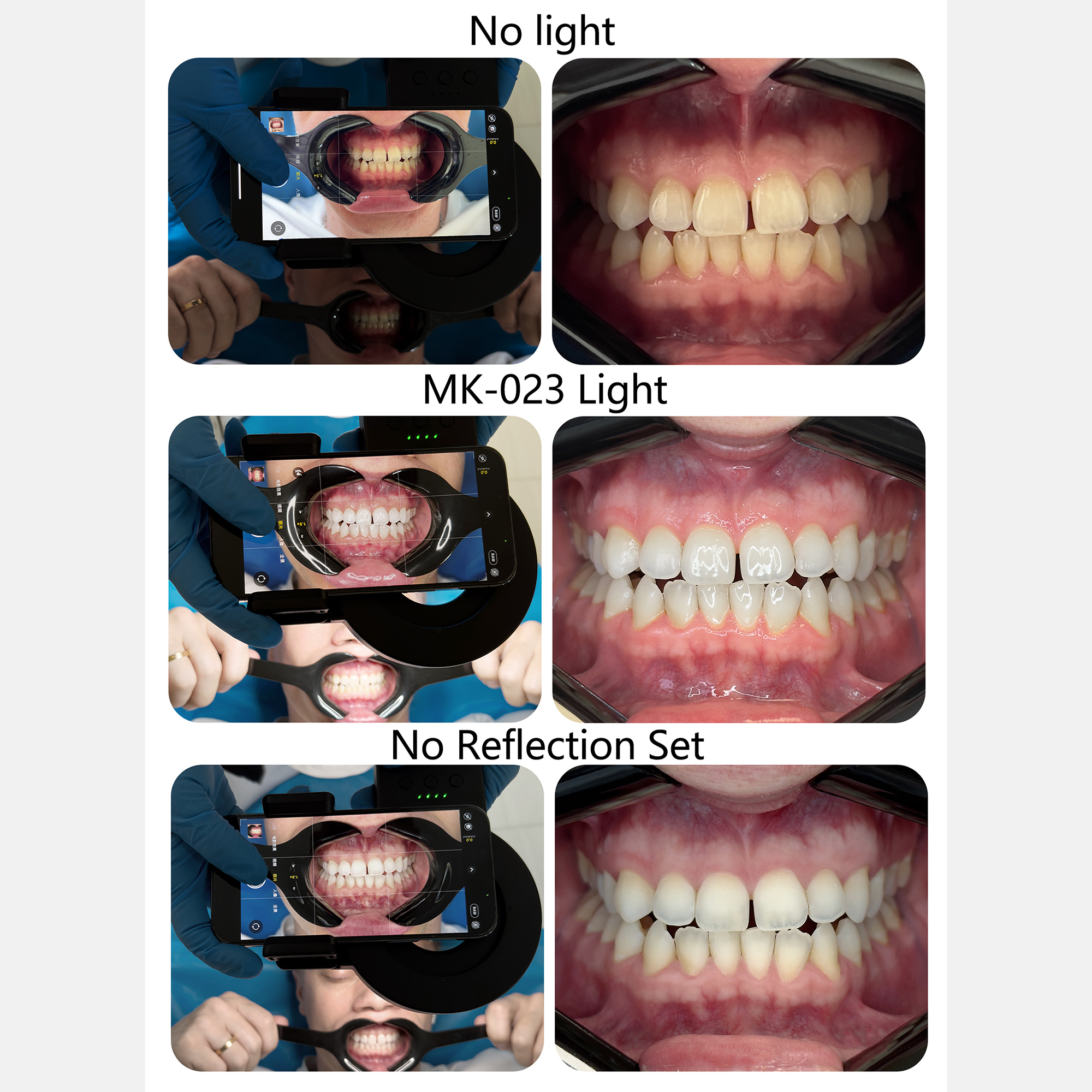 HERA MK-23 Intraoral Dental Ph – Photography Lighting Lamp recenzja i cena